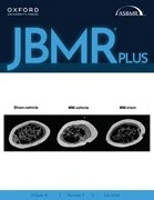 JBMR® Plus
